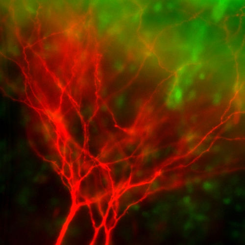red neurons
